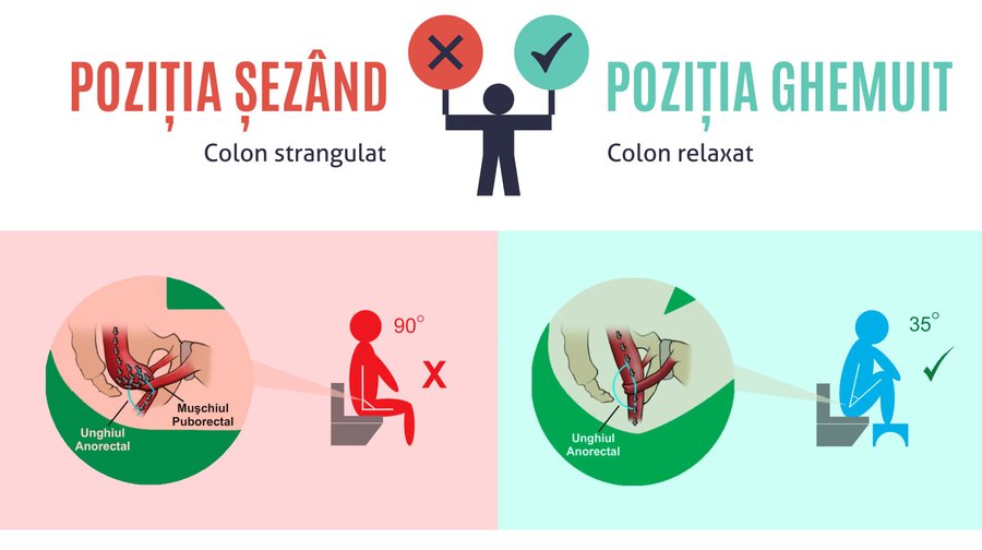 Ilustrație comparativă în limba română, cu titlurile „Poziția șezând” și „Poziția ghemuit”: la stânga o persoană așezată pe vasul WC, cu trunchiul și coapsele la 90°, alături de o schemă anatomică; la dreapta o persoană cu picioarele ridicate pe un taburet, în poziție ghemuit, la 35°, alături de schema anatomică corespunzătoare